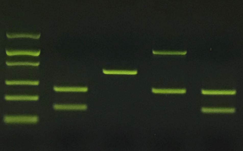 Electrophoresis Forensics Lab: Wrongfully Convicted?