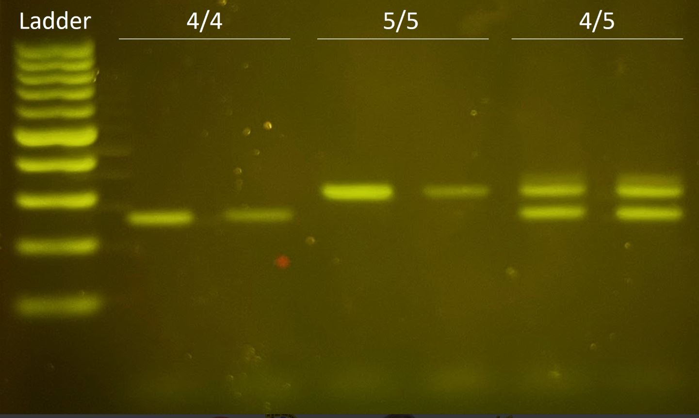 Polymerase chain reaction (PCR) with own DNA