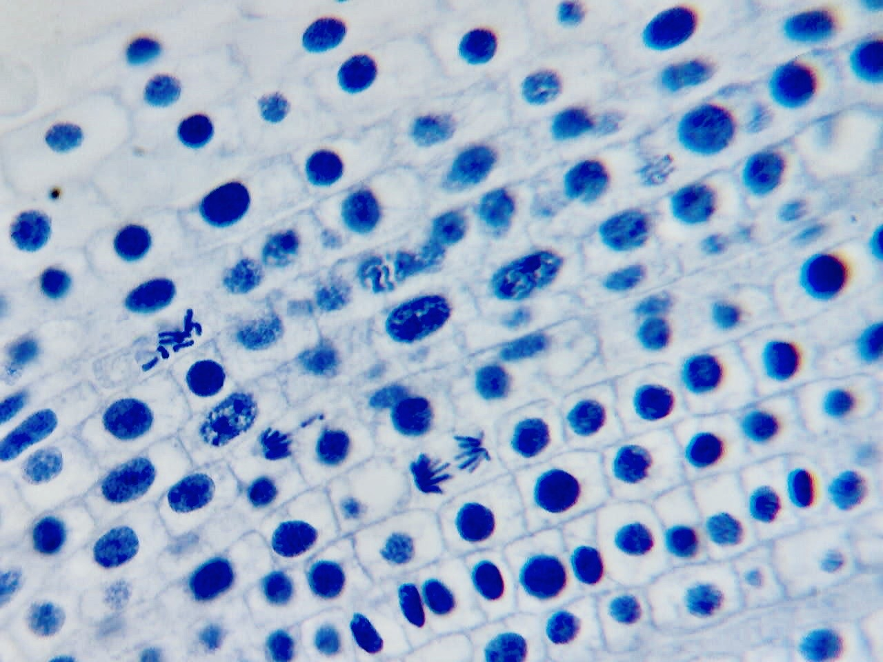 PHYWE Prepared microslides Mitosis in storage box, 10 identical slides