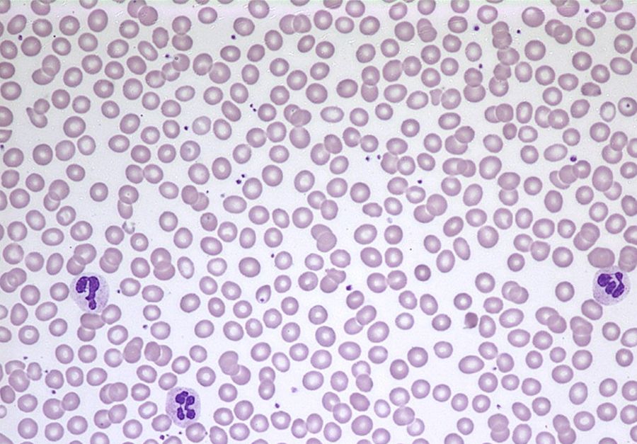 Blood under the microscope