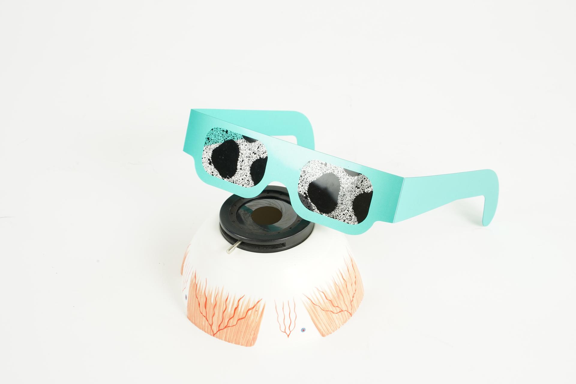 Glaucoma
