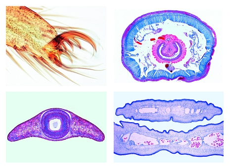 Invertebrata, elementary set, 25 microscope slides
