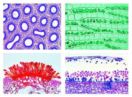 Cryptogamae, supplementary set I, 25 microscope slides
