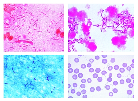 Pathogenic Bacteria, 25 microscope slides