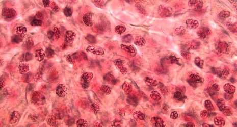 Nucleus and chromosomes - mitosis