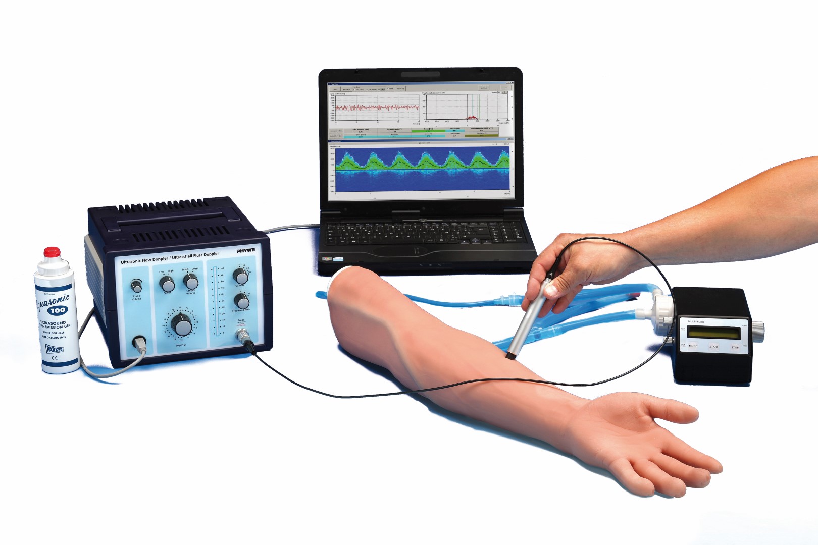 Doppler sonography